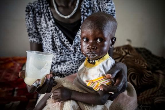 Artiklar om svält - UNICEF Sverige | unicef.se